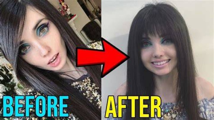 Eugenia Cooney Is FINALLY Healthy! YouTube