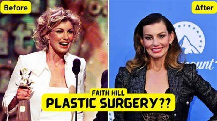 Faith Hill Plastic Surgery A Youthful Look For A Country Star